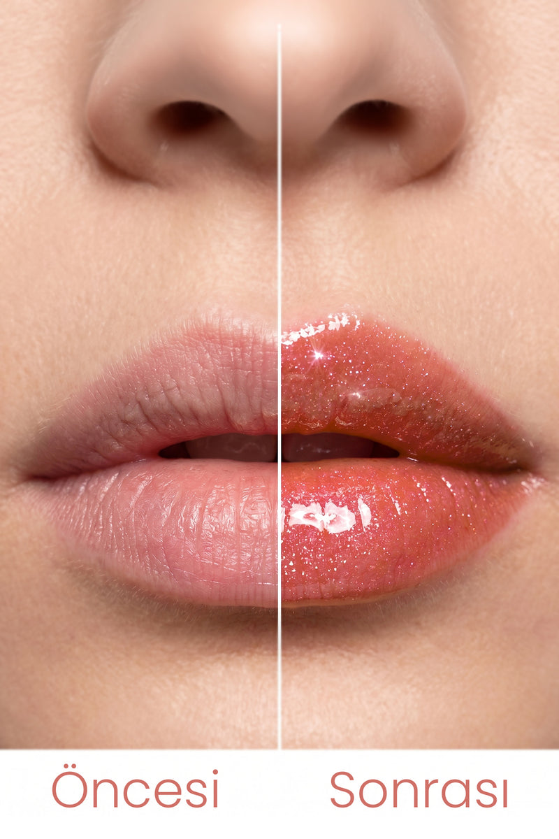 Shıne Lıpgloss 5 Ml